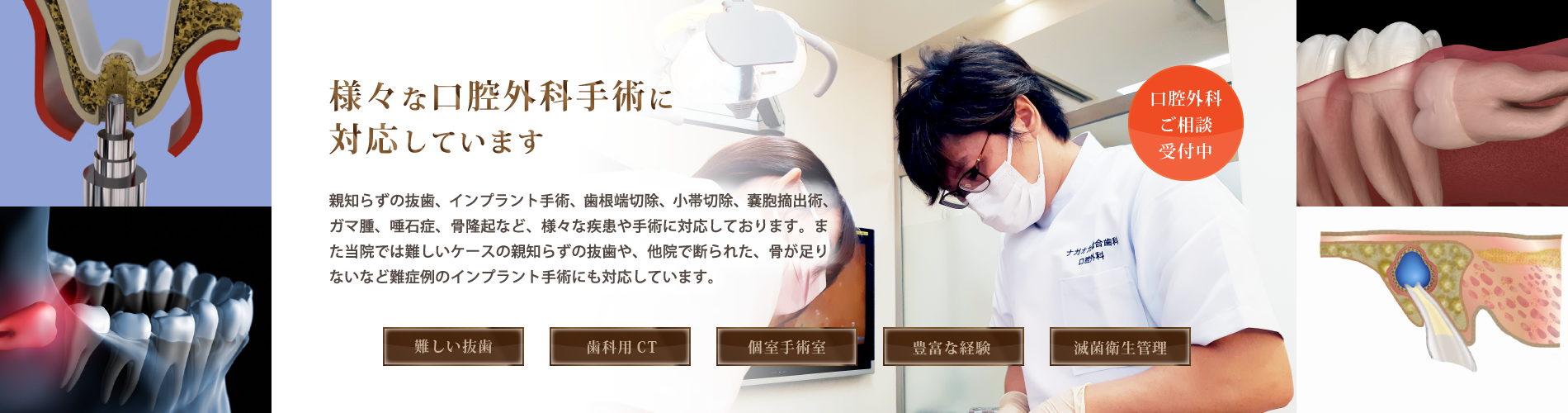 難易度の高い親知らずの抜歯にも対応する