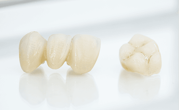 天然歯に近い美しさと耐久性を実現するメタルフリーの選択肢