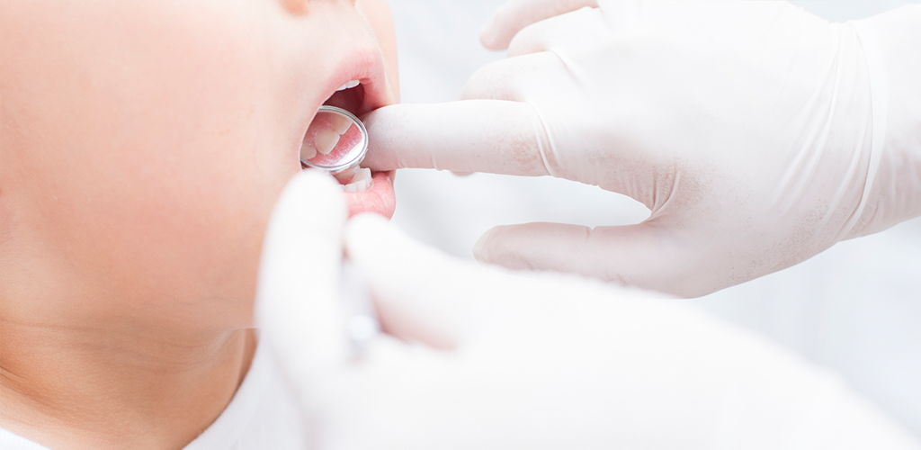 お子様のお口の心配事はお気軽にご相談ください