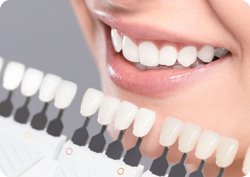 歯を削ったりはせずに専用の薬剤を使用して希望の白さに整える