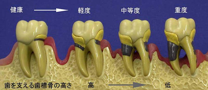進行度に合わせた的確な処置でお口の健康を守っています