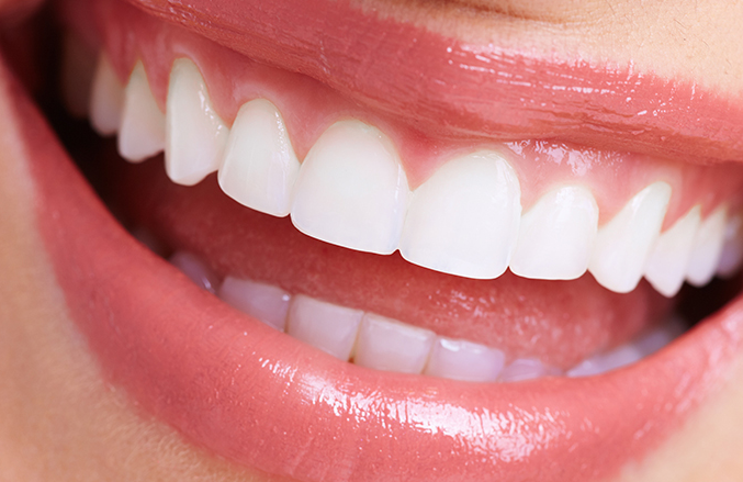 多彩な素材と最新技術で理想の歯を実現するセラミック治療