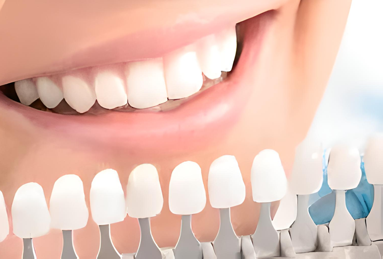 専門認定医院による最新技術と患者の歯質に合わせた安全施術