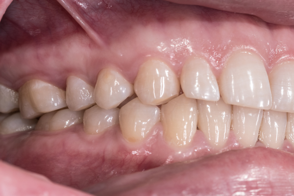 ※画像はイメージです