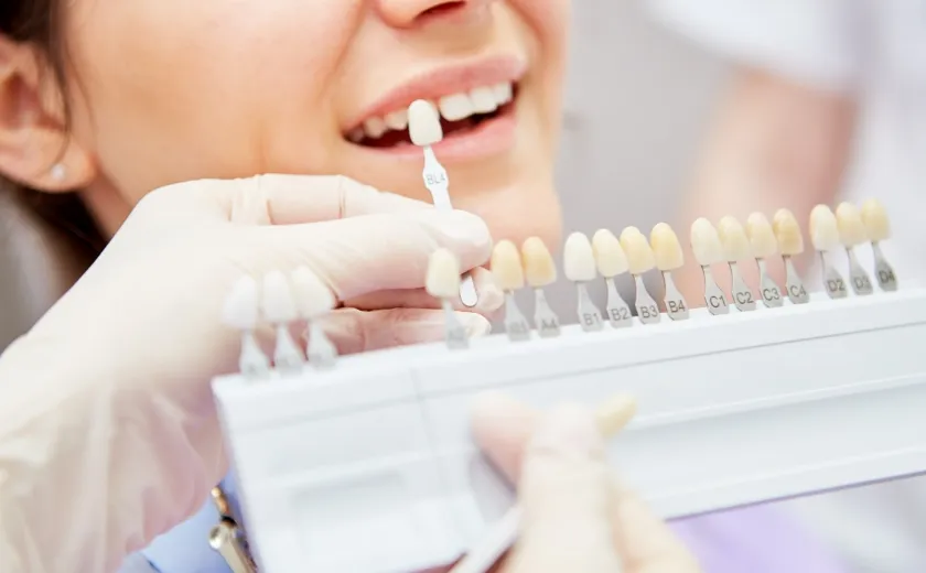 専属の技工士が細かな色味を調整しています