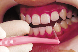 健康な歯を守りましょう