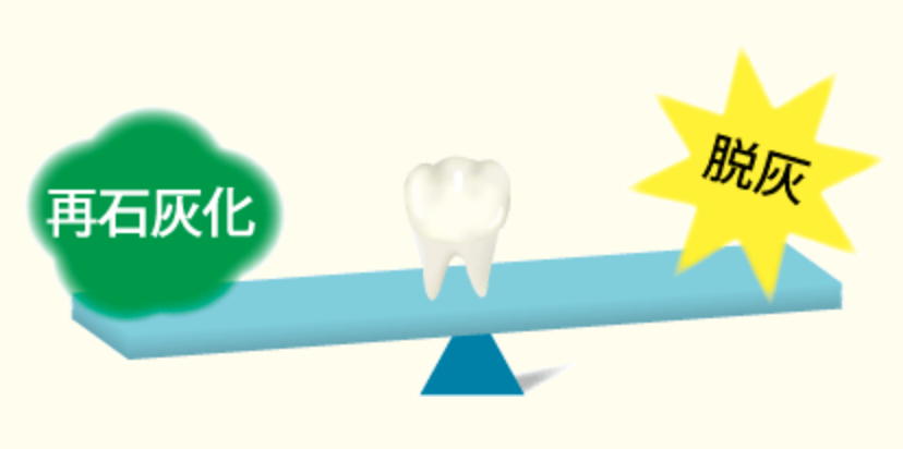 歯を削らない治療を心がけています