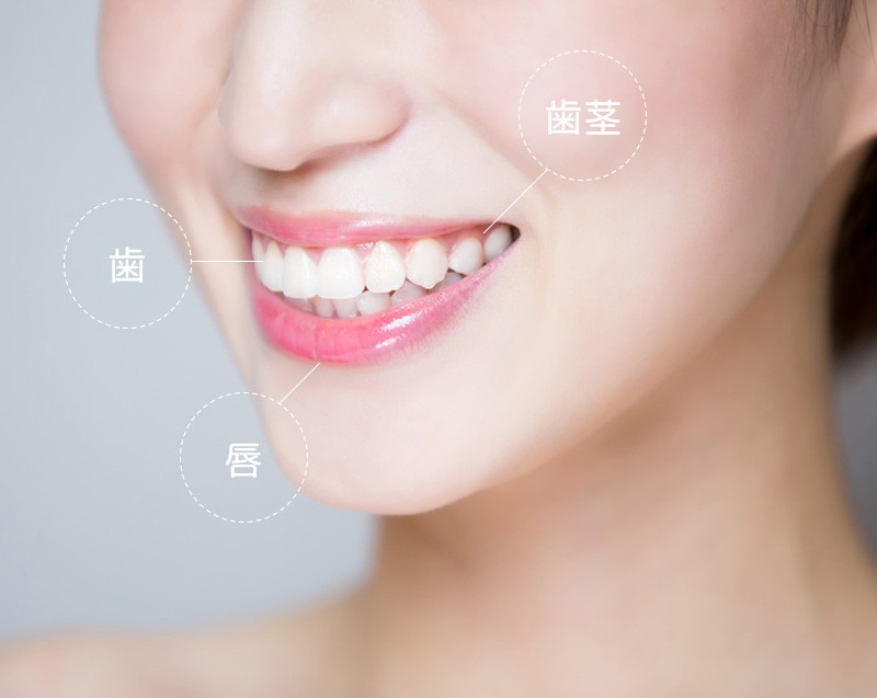 歯の色と形を整えて健康的な美しい口元を創り出しています