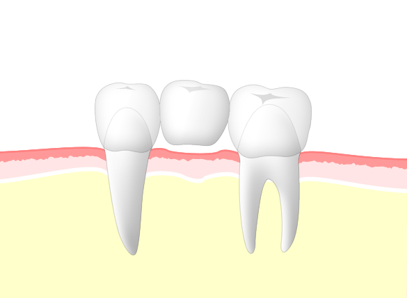 仕上がりの美しさにもこだわり、世界トップレベルの歯科技工所と提携しています