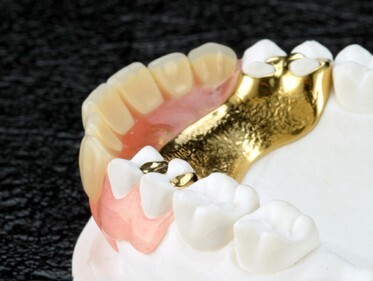 最適な入れ歯をご提案いたします