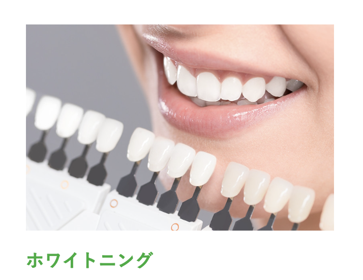ご自宅で実践できるホームホワイトニングをご提供しています
