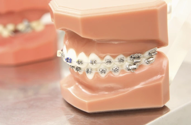 歯並びと健康を整えるハローデンタルクリニックの矯正歯科