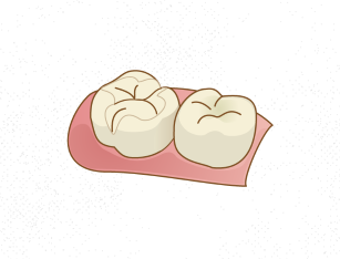 適切な治療方法を選択することが、患者様の健康と満足につながります。