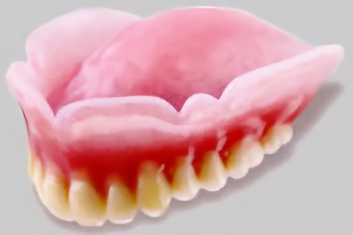 コンフォート義歯