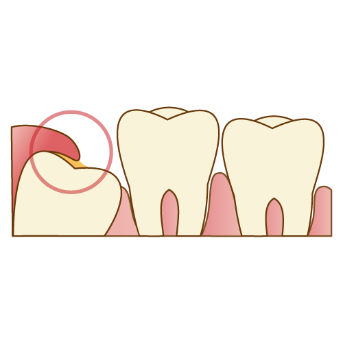 写真はイメージです