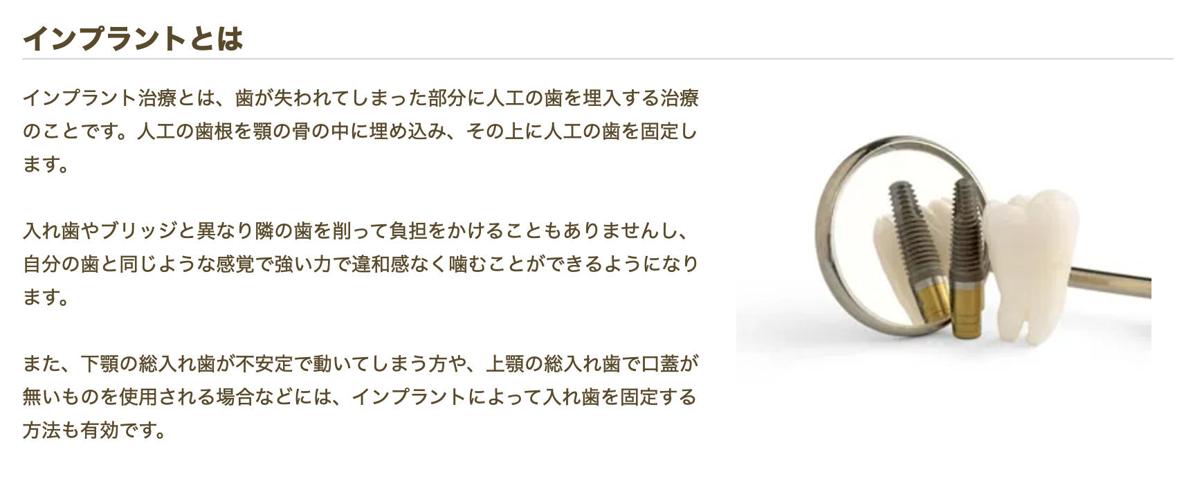 見た目だけでなく噛む力や発音の改善にも優れた効果を発揮します