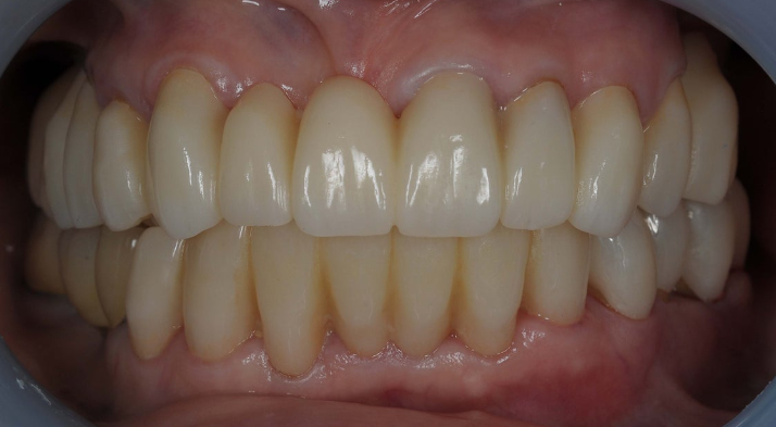 高い技術の審美歯科を提供しています