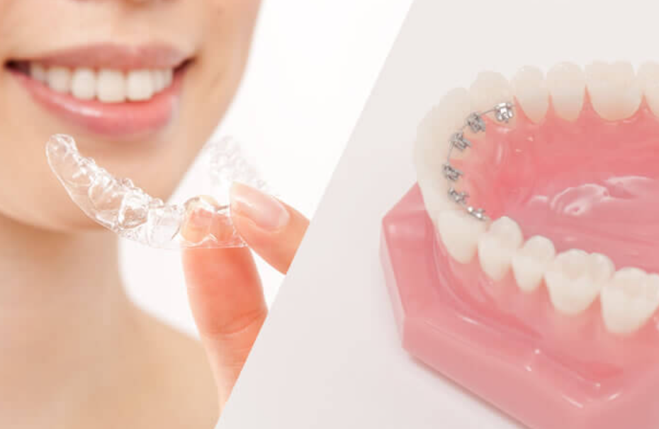 目立たぬ二種の矯正と治療法切替で患者に合わせた柔軟な対応を実現