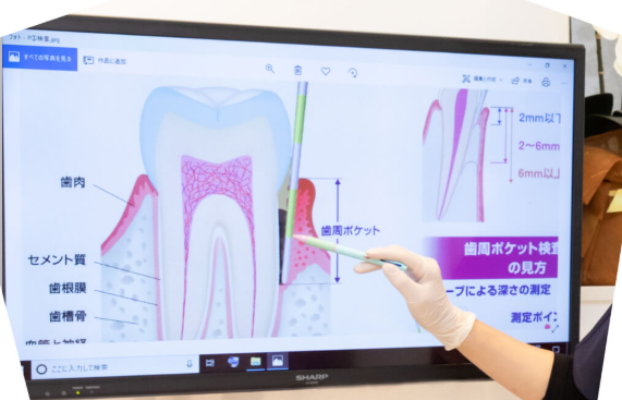 重度の歯周病の患者様も諦めずご相談下さい