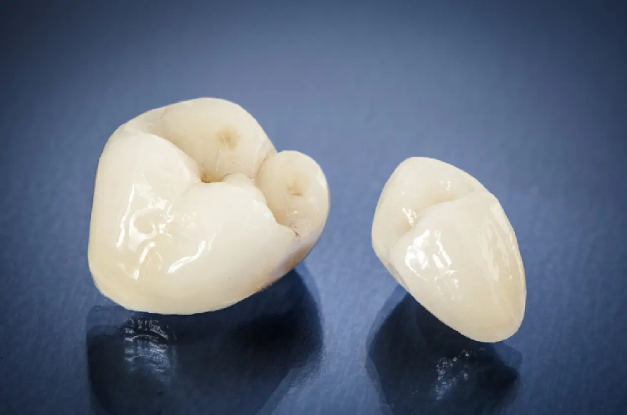 自信が持てる口元へ導く治療