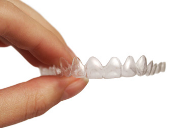 歯科矯正治療で笑顔あふれる歯並びを作る