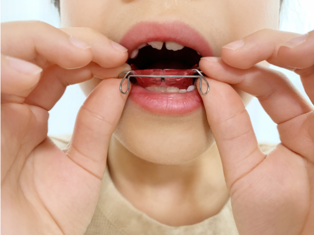 専門家による早めの診断・治療がその後の健康な口腔環境を維持するカギ