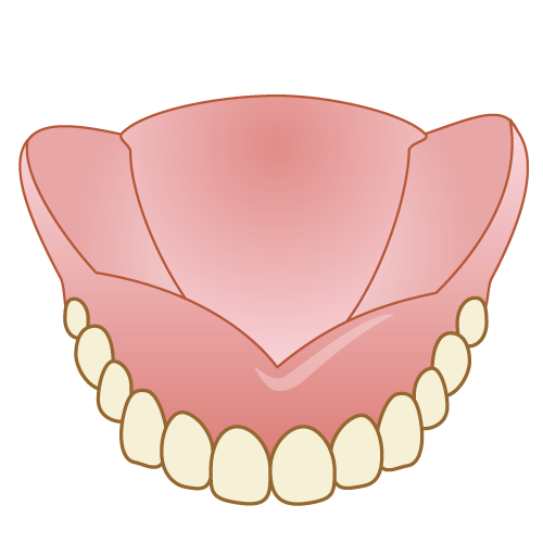 あなたの笑顔と機能を取り戻す入れ歯