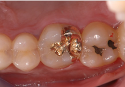 早めの治療が大切です