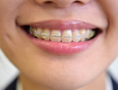お子様から大人まで幅広い年代に対応し、患者様の将来のお口の健康を見据えながら、一人ひとりに寄り添った矯正歯科治療をご提供しています。