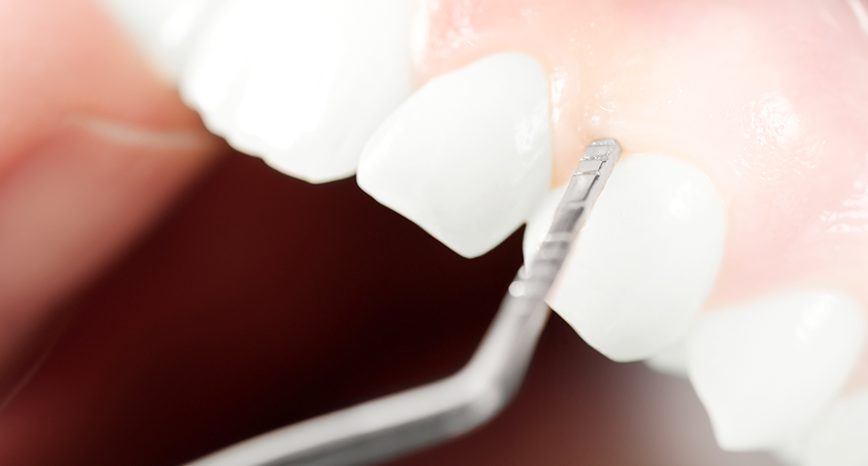 【阪急千里線 天神橋筋六丁目駅から徒歩10分】大阪でも数少ない小児歯科専門医が在籍しお子様に適した歯科治療を行う「みずのファミリー歯科」