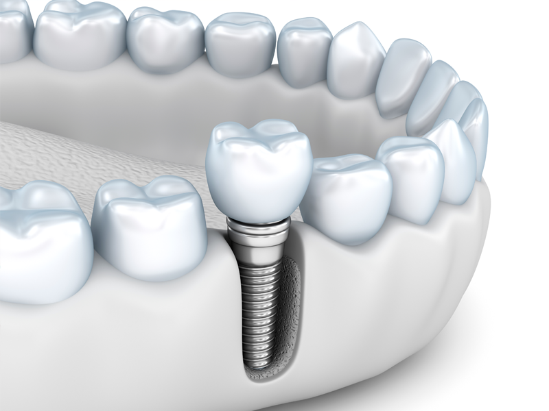 ※画像はイメージです。