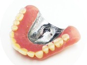 患者様一人ひとりに合った入れ歯を提案しています