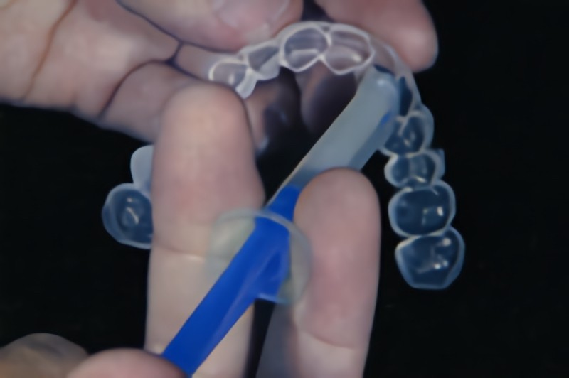 ホームホワイトニングを取り扱っています