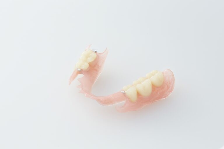 ノンクラスプデンチャーという金属のばねが無い入れ歯です