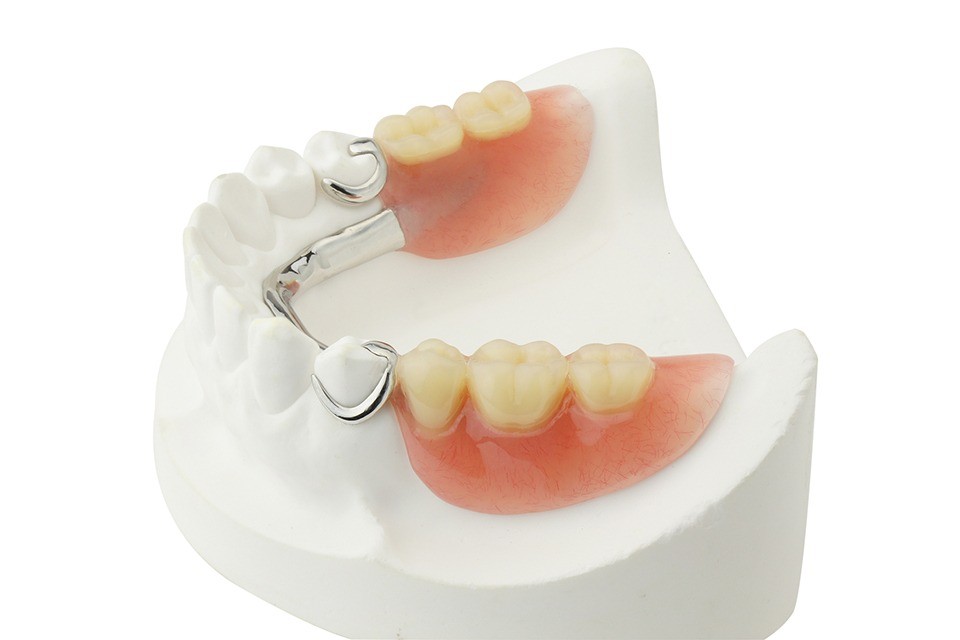 患者様一人ひとりの希望や口腔内の状態に合わせた治療方法を提案しています。