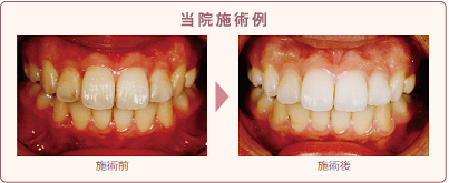 見た目を整えることを重視した治療です