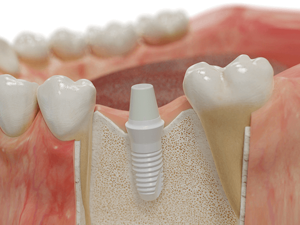 清潔なオペ室でマイクロスコープを用いた精密な手術を行います