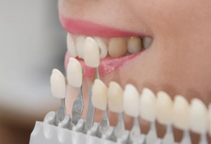 自信の持てる口元へ