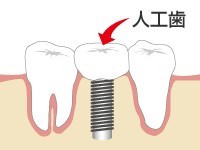 わかりやすい説明を心がけており、患者様に理解・納得していただいてから治療を進めることを大切にしています