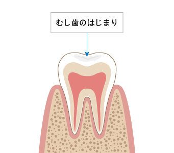 むし歯と歯周病を最も多く扱う悩みとして早期発見・早期治療に注力しています