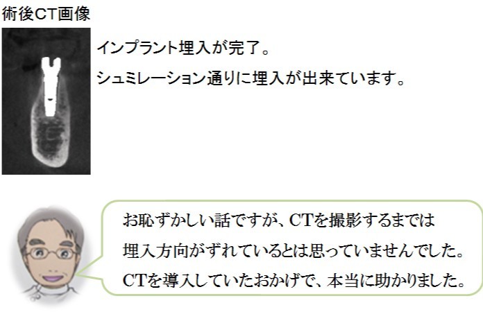 術中CTが手術の安全性と精度を高めるうえで大きな役割を果たしています