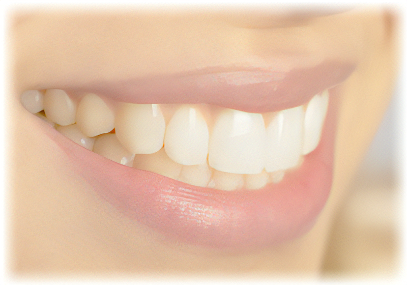 ホワイトニング