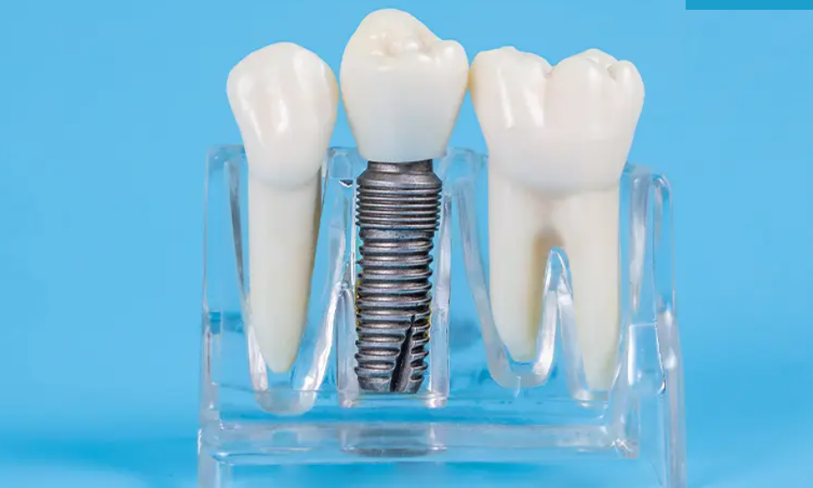 マイクロスコープやCT撮影を活用した治療にあたっております