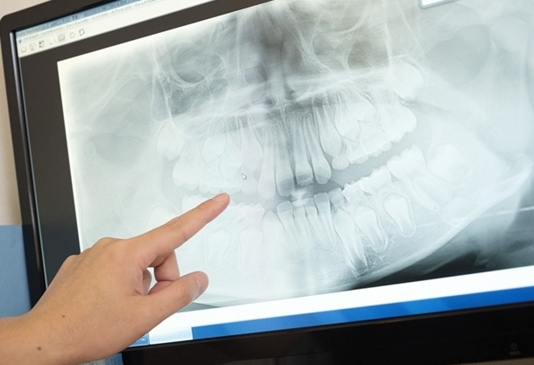 歯の保存にこだわった丁寧な診断とマイクロスコープによる高精度治療