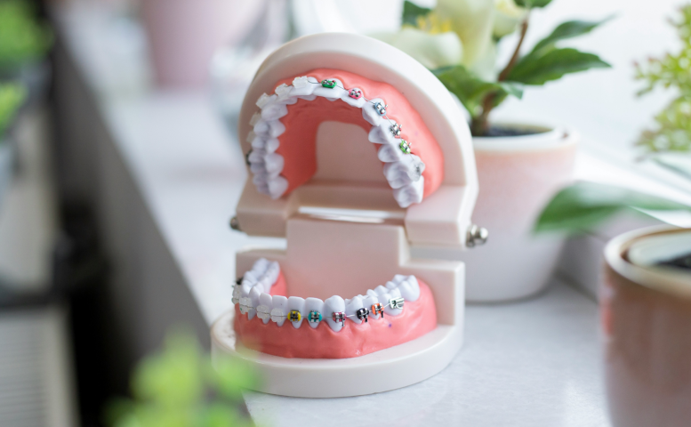 生活に寄り添うフィットする入れ歯