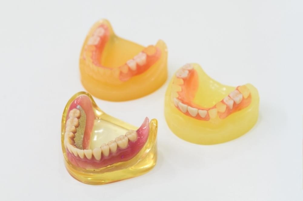 見た目や快適性を重視する患者様には、自費の入れ歯「キレイデス」を提案しています。