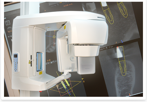 治療前には歯科用CTで立体的に撮影し、顎の骨や神経の状態を把握したうえでインプラントを行います