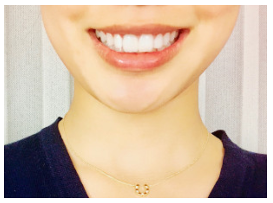 健康と美しさを考えた、最適な歯科治療を