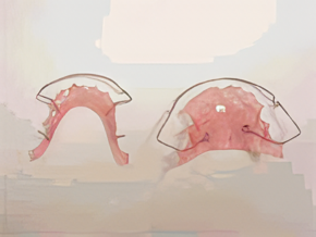 磯貝矯正歯科医院では、治療の各ステップにおいて丁寧な説明とサポートを心がけ、安心して矯正治療に取り組んでいただける環境を整えています。