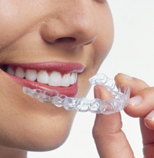 【日本矯正歯科学会指導医在籍】患者様に合った矯正装置と確かな技術で矯正歯科治療を提供するグレイス矯正歯科クリニック